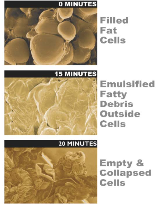 fat-cells-melting