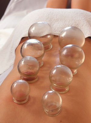 cupping