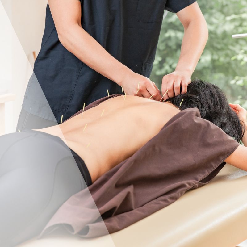 Acupuncture San Luis Obispo